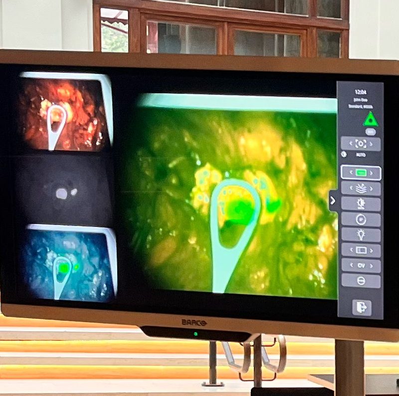 Clinical case "Lymph Node" ICG-Card