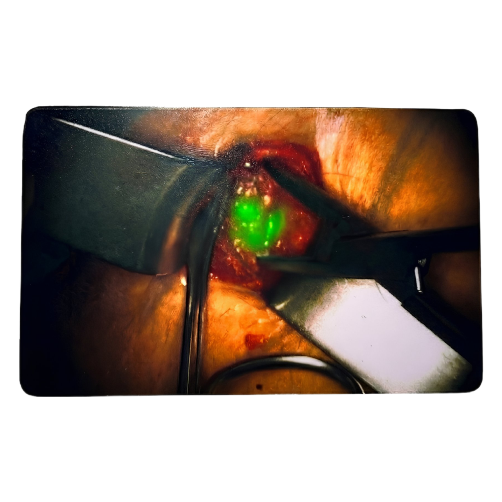 Clinical case "Incision" ICG-Card
