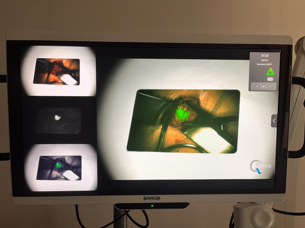 Clinical case "Incision" ICG-Card