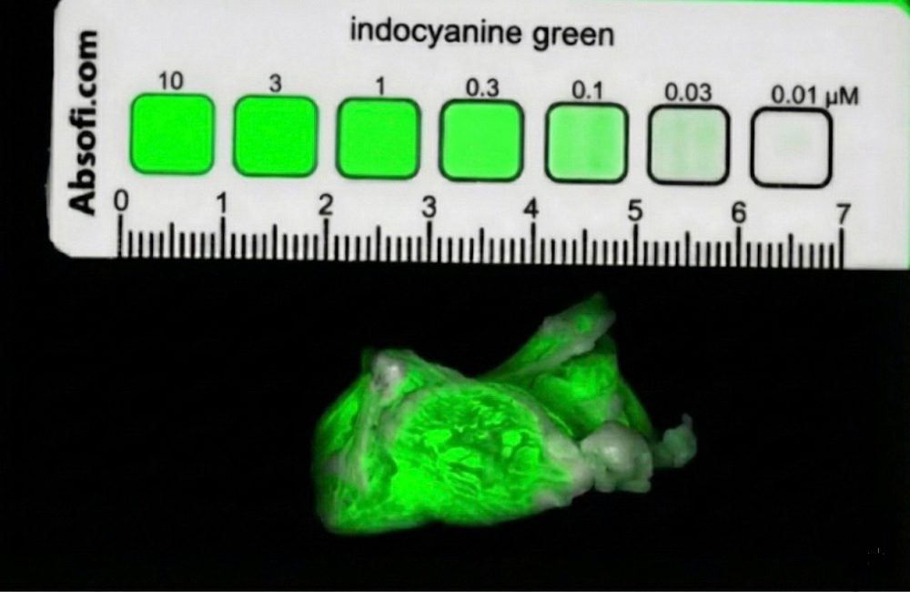Concentration target (reference phantom)