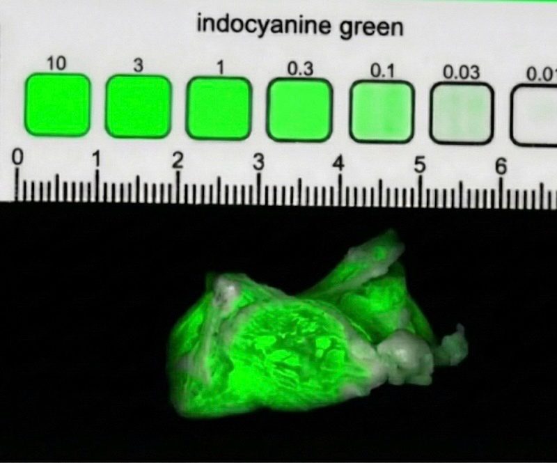 Concentration target (reference phantom)