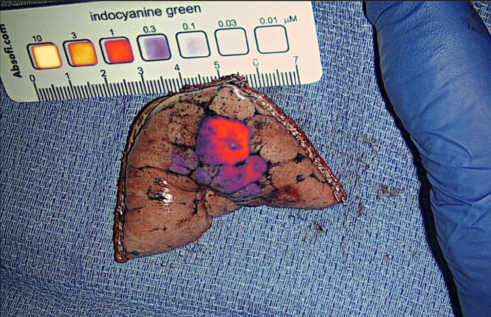 Innovation Spotlight: University of Pennsylvania Study at WCLC 2025 Highlights the Value of Absofi NIR Reference Targets with Integro’s LS301